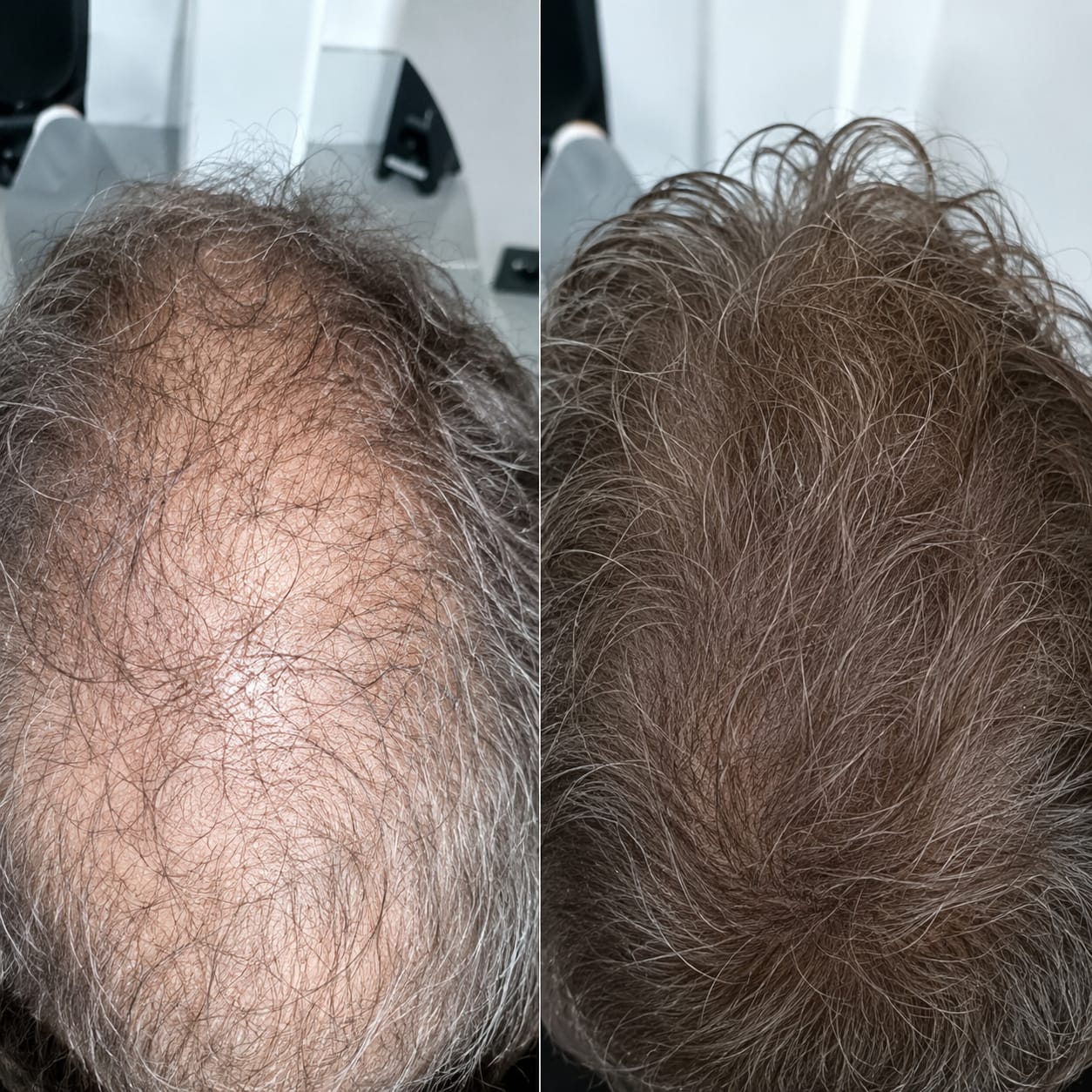 Resultado 1 — antes e depois