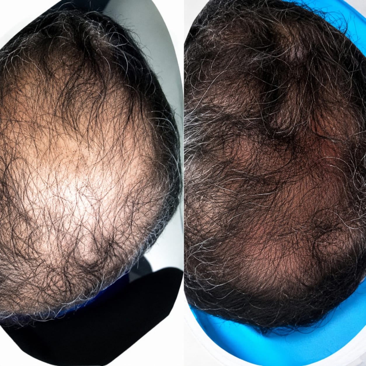 Resultado 2 — antes e depois
