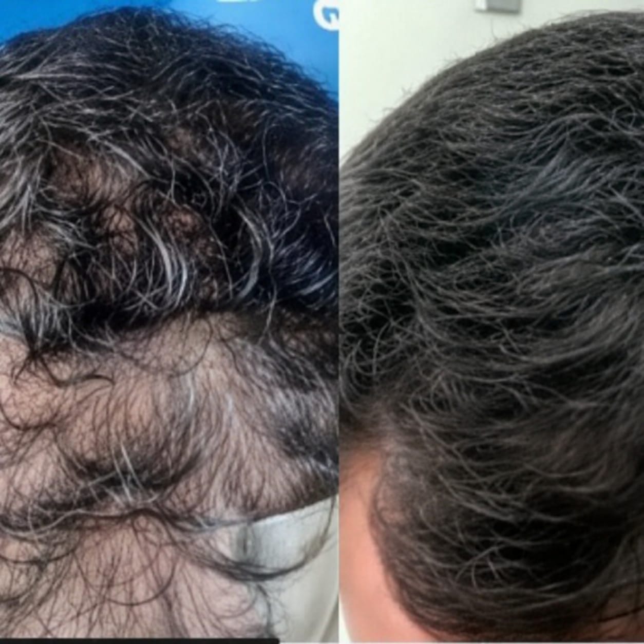 Resultado 3 — antes e depois